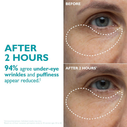 Elyviana Hydro-Gel Face & Eye Patches | Anti-Wrinkle & Hydrating (Upsell)